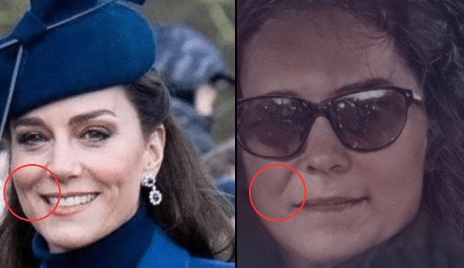 Kate Middleton Photos Spark Wild Theory Over ‘Missing Mole’