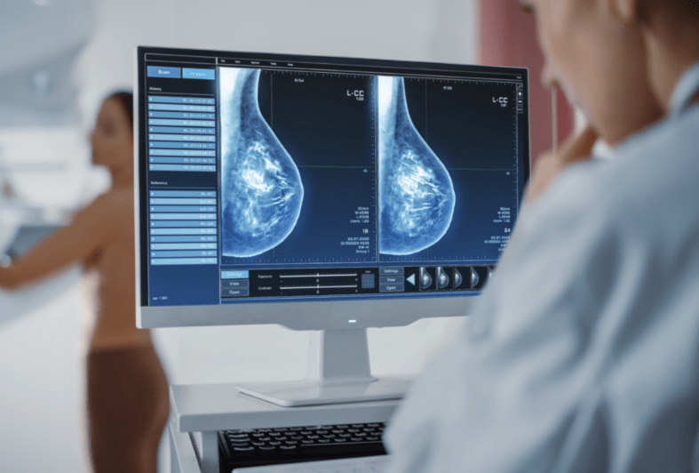 Australian women are wary of AI being used in breast cancer screening – new research
